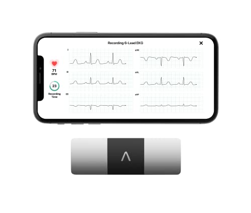 Read more about the article Top 9 ECG & Heart Monitors (2025): Expert-Reviewed Devices for Personal Wellness